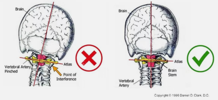 Atlas Vertabra